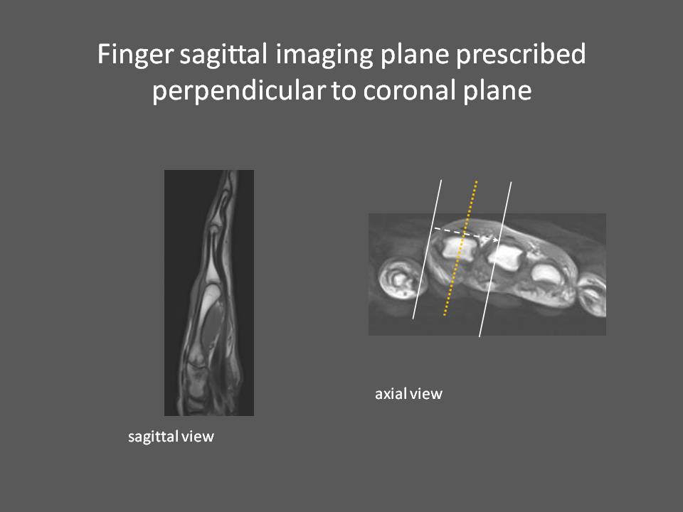 MRI Wrist How we do it How is MRI Wrist done at Mater Dei Hospital
